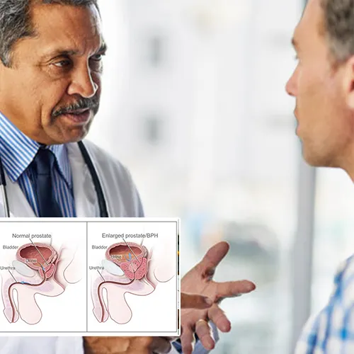 The Confidence You Deserve: Choosing  Advanced Urology Surgery Center 
 


