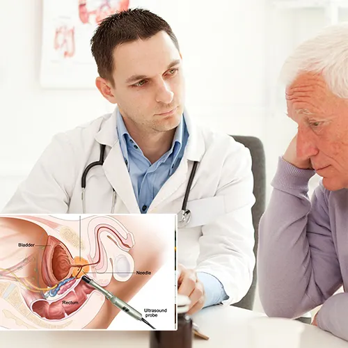 Understanding the Penile Implant Procedure