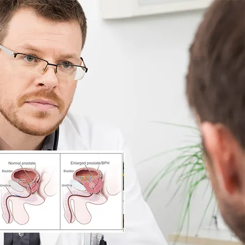 Welcome to  Advanced Urology Surgery Center 
 



: Premier Solutions for Penile Implant Surgery